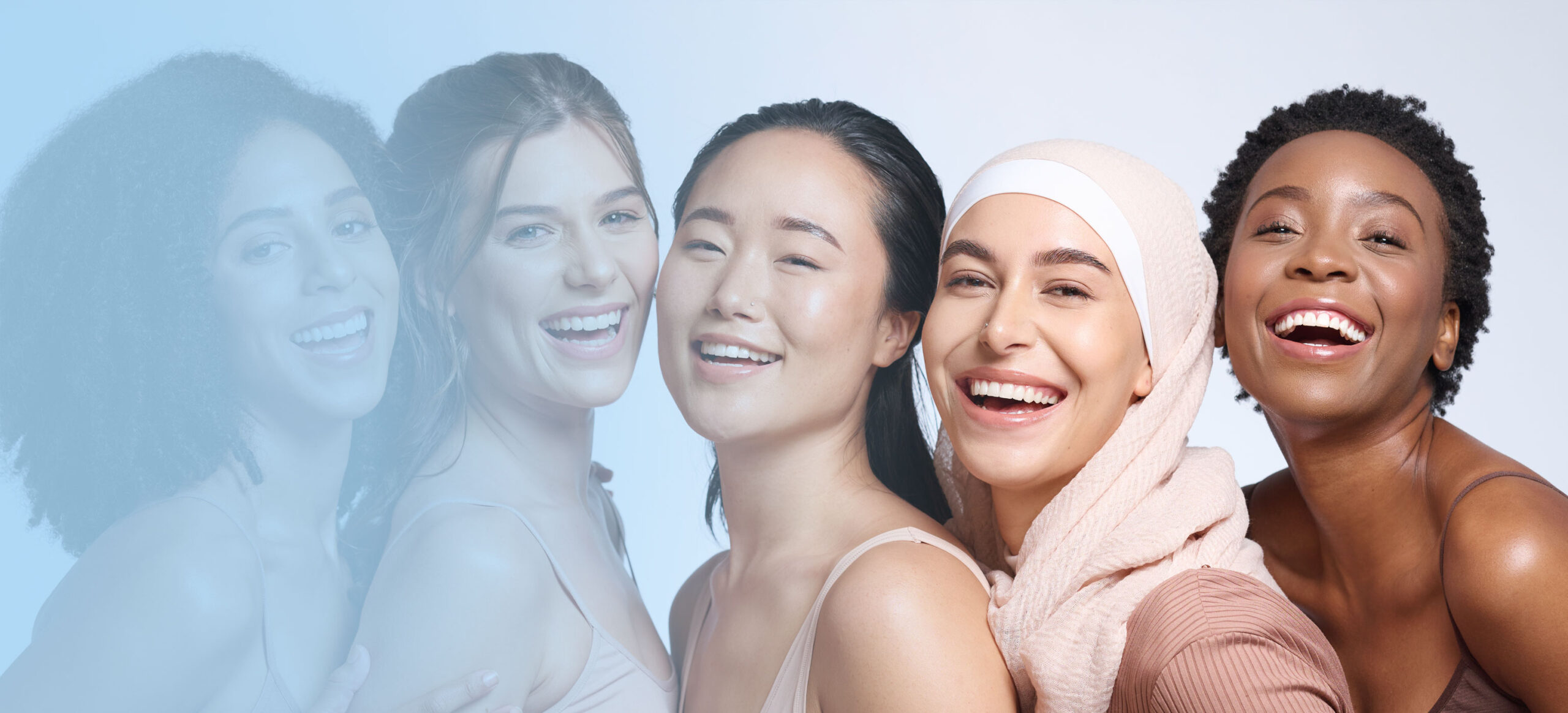 UltraThineer Veneers